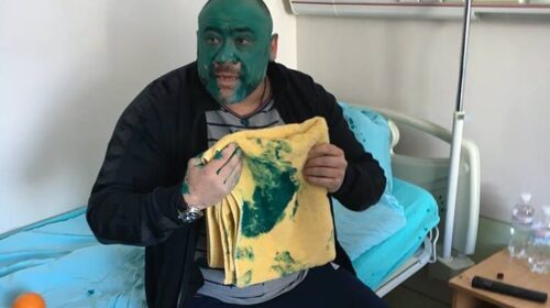 "Шрек" в Інституті серця. Співучаснику вбивства журналіста Веремія зеленкою розмалювали обличчя