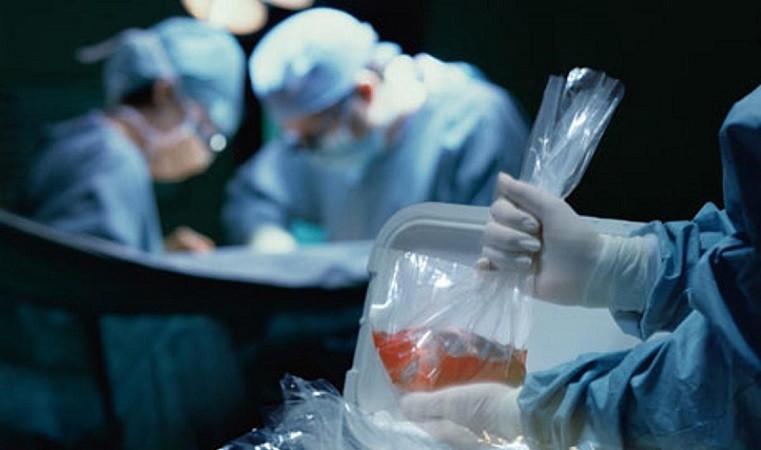Рада ухвалила закон про трансплантацію. Чому жертви ДТП не підуть "на запчастини"