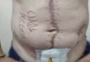 Окупанти випалили на тілі полоненого воїна ЗСУ напис “слава росії”. Медик шокував новими подробицями